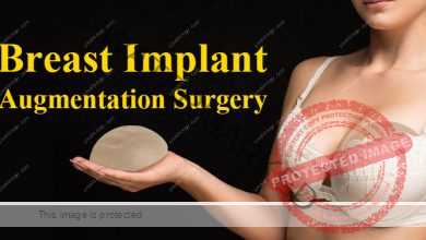 Photo of Breast Implant  / Augmentation Surgery in Dhaka, Bangladesh